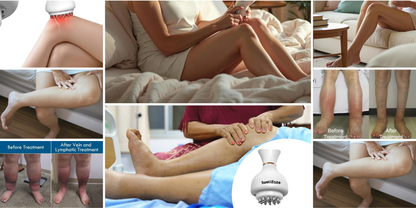 SwellEaze 4 in 1 Therapy Massager